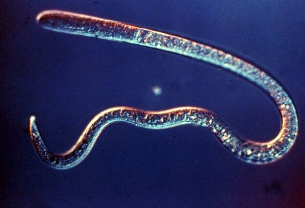 trichinella z lidského těla